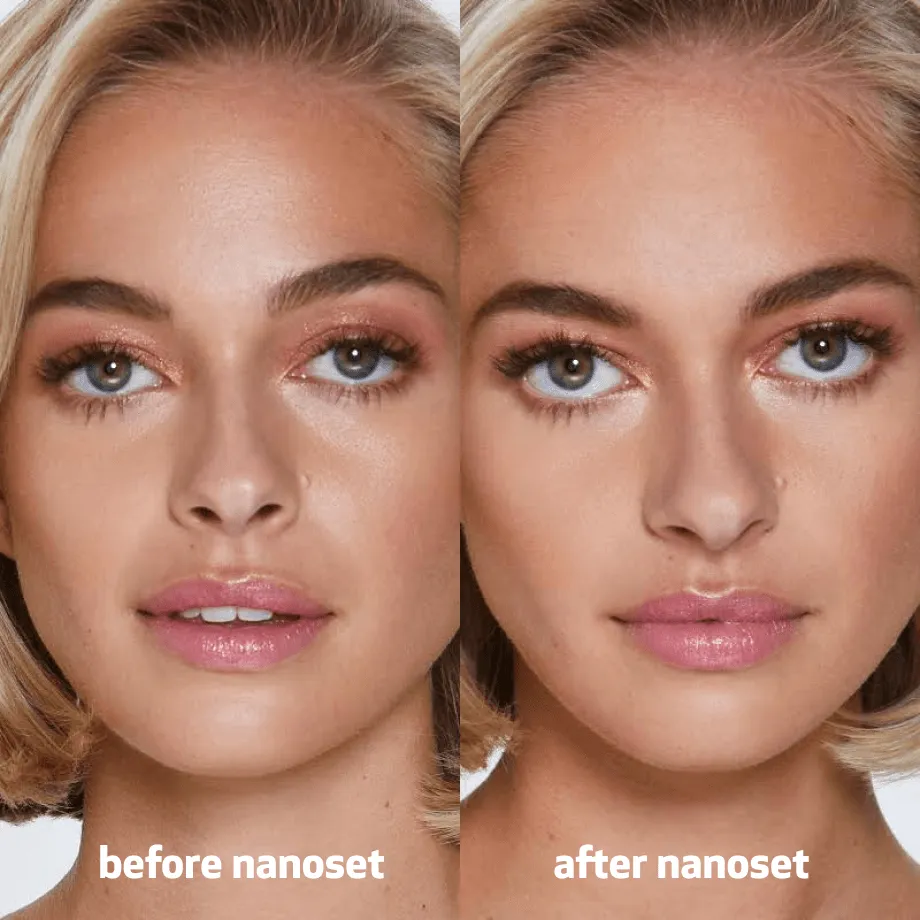 nanoset™