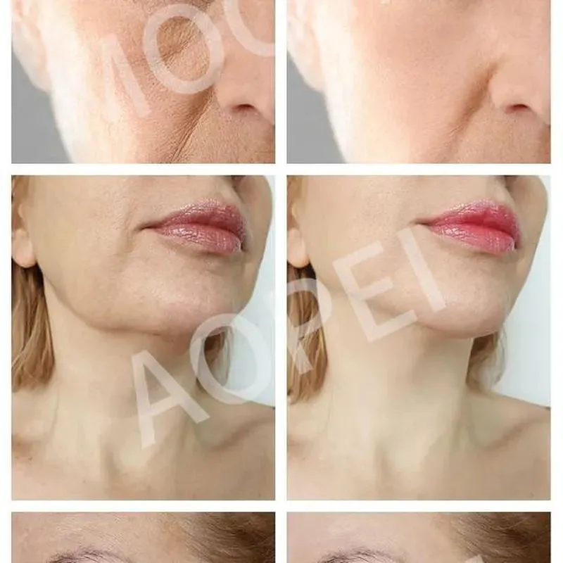 Retinol Face Cream: Anti-Aging, Wrinkle Whitening, Moisturizing, Improves Fine Lines, Firming, Lifting Facial Skin Care